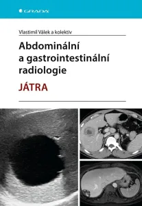 Abdominální a gastrointestinální radiologie, Válek Vlastimil