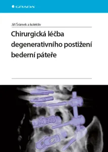 Chirurgická léčba degenerativního postižení bederní páteře, Šrámek Jiří #3688207