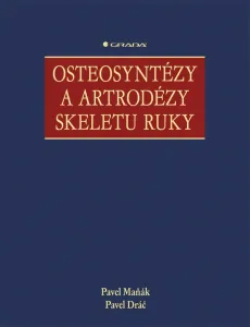 Osteosyntézy a artrodézy skeletu ruky, Maňák Pavel #3687259