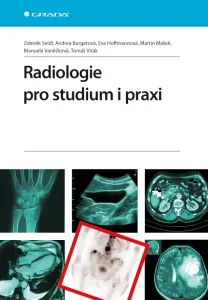 Radiologie pro studium i praxi, Seidl Zdeněk #3687425