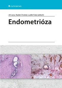 Endometrióza, Lenz Jiří