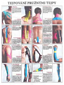 Vydavateľstvo Poznání Anatomický plagát - Tejpovanie pružnými tejpmi